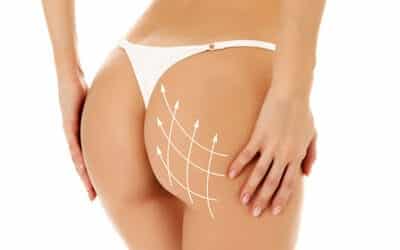 Contorno glúteo 3D: Você Não Vai Acreditar nos Resultados!