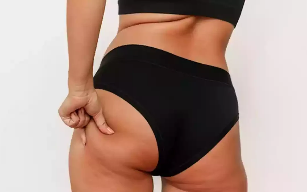 Melhora da flacidez glútea: Você não vai acreditar no que descobrimos!
