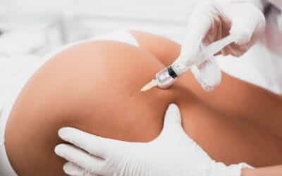 Harmonização glútea com PMMA: Você Sabia Que Pode Transformar Seu Corpo?